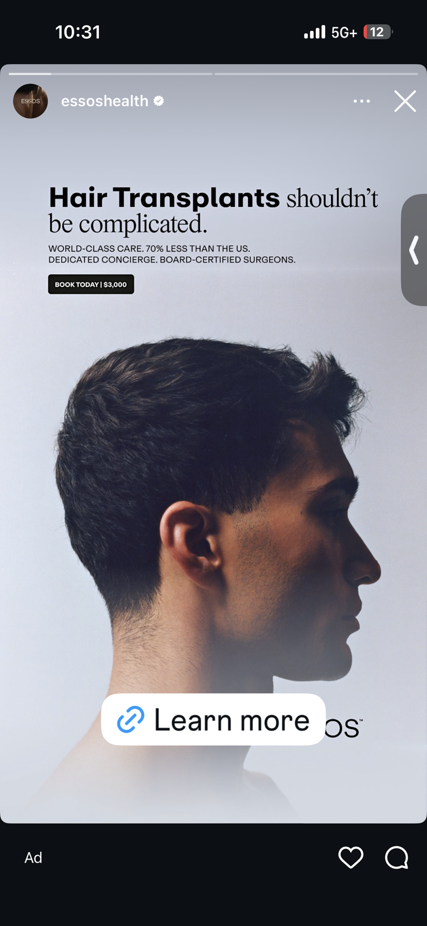 MVT6555 cover